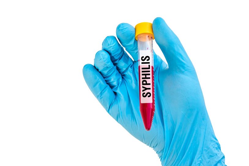 does-syphilis-show-up-in-a-routine-blood-test-editorialnet