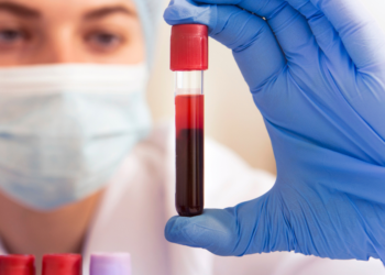 Blood Test Result